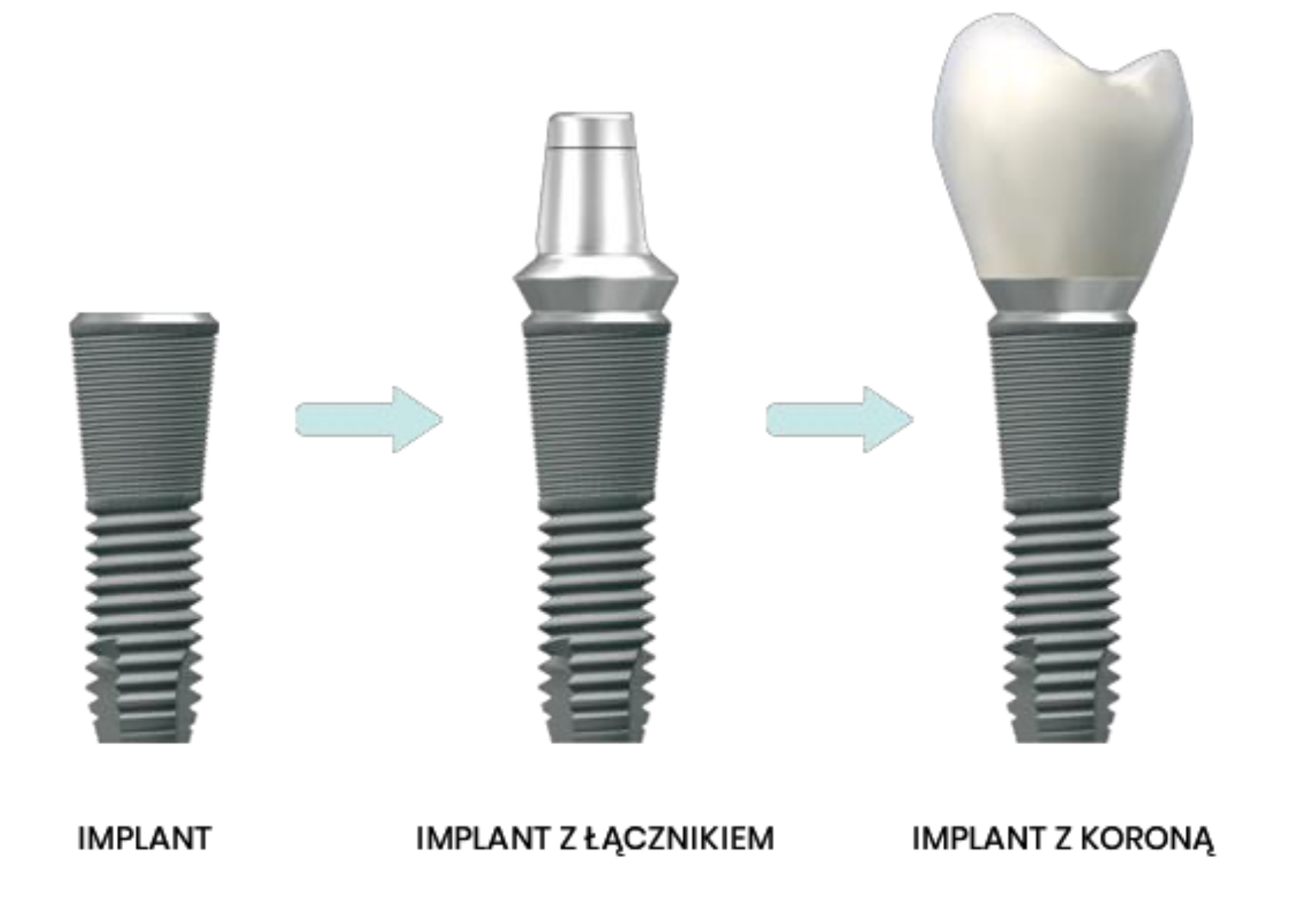 implant stomatologia skórzewo